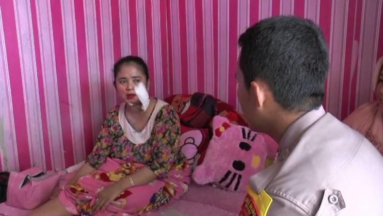 3 Perempuan Jadi Korban Begal Sadis Bercelurit di Bekasi, 1 Kritis dan 2 Luka Parah 