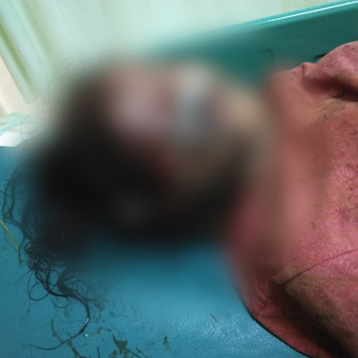 Diduga Korban Penganiayaan, Seorang Gadis Muda Ditemukan Tergeletak di Semak Belukar dengan Wajah Babak Belur