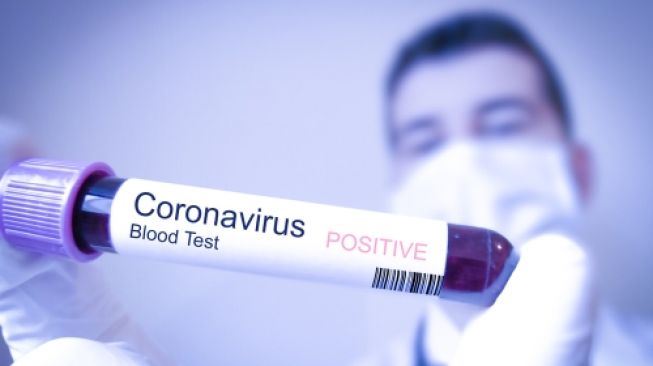 Korban Meninggal Akibat Virus Cotrona Bertambah, Total Jumlah Korban Mninggal Saat ini 803 Orang, Melebihi Wabah SARS