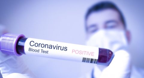 Pria Berusia 60 tahun Menjadi WN Prancis Pertama yang Meninggal Akibat Virus Korona, Jumlah yang Terinfeksi Saat ini Menjadi 17 Orang