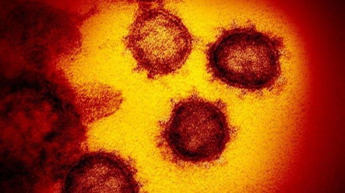 Keluarga di Pontianak Positif Terinfeksi Virus Corona, Tetapi Anak Balitanya Negatif Covid-19
