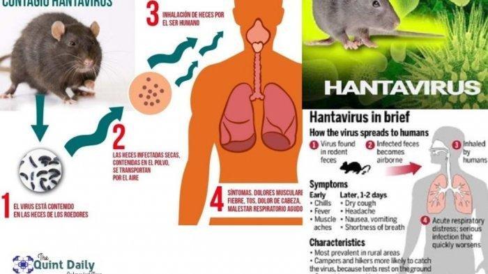 Ternyata Hantavirus Masuk Daftar Virus Paling Mematikan di Dunia, Virus Rabies Hancurkan Otak