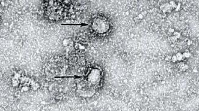 Ilmuwan Islandia Temukan 40 Mutasi Virus Corona