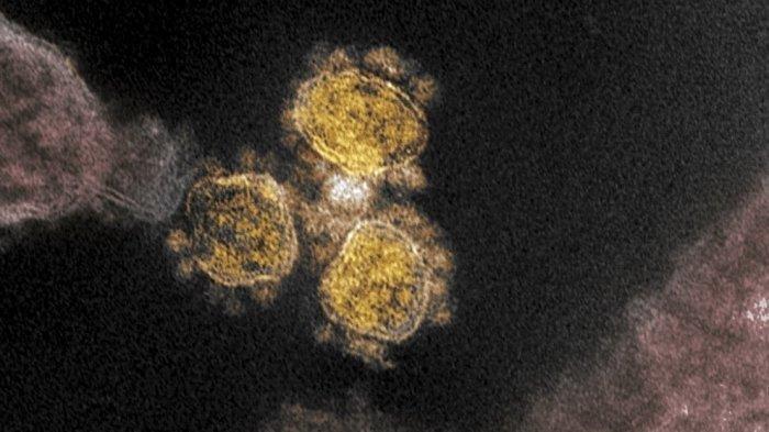 Menghindari Paparan Virus Corona, Terapkan Cara Ini di Keluarga Agar Tak Terkena Covid-19