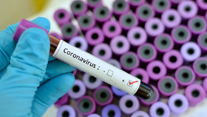 Seorang Warga Ciamis Positif Terinfeksi Virus Corona, Usai Menjenguk Pasien Positif Corona di Rumah Sakit Metro Bogor