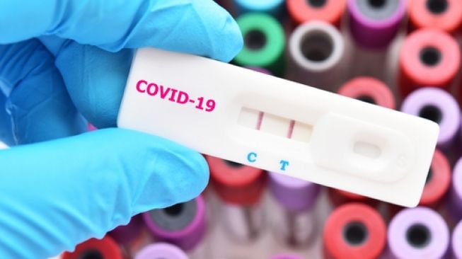 Hasil Tes Covid-19 Bisa Negatif Palsu, Ahli Khawatir Penularan Virus Meluas