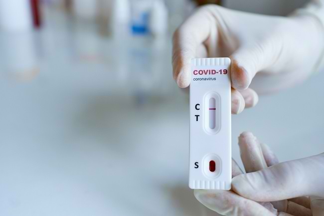 Hasil Rapid Test Virus Corona, Belasan Pedagang Tradisional di Kabupaten Bantul Menunjukkan Rekatif