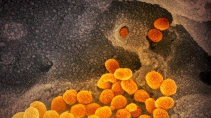 Virus Corona di Indonesia Jauh Lebih Ganas dan Lebih Cepat Menular, Temuan LBM Eijkman