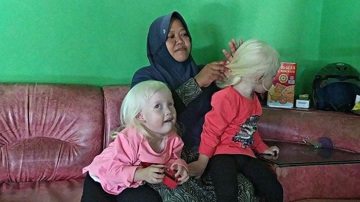 VIRAL, Dua Balita Albino di Wonogiri Jawa Tengah, Warga Sempat Kira Anak Bule