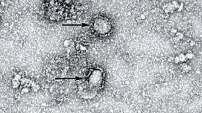 Peneliti AS Temukan Varian Baru Mutasi Virus Corona Colombus
