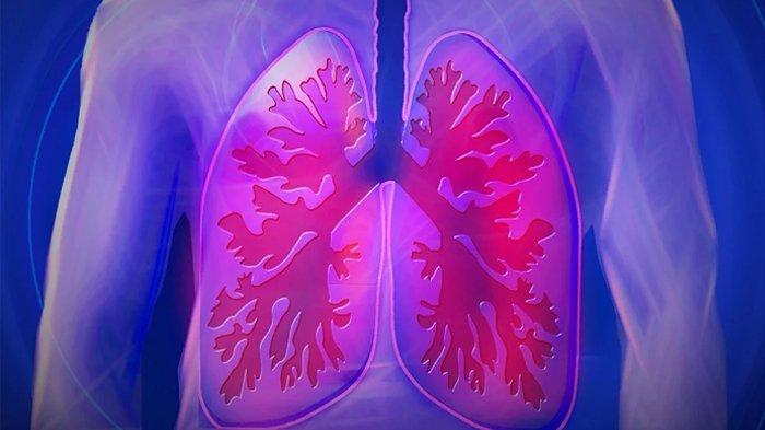Penting Saat Pandemi Covid-19, Begini Cara Bersihkan Paru-paru Dengan Cara Alami