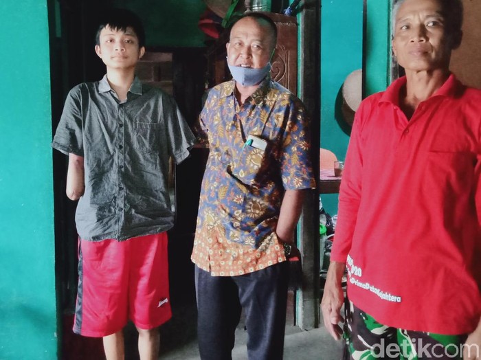 Viral Kisah Pilu Pelajar SMK di Klaten Kehilangan 2 Tangannya Saat PKL