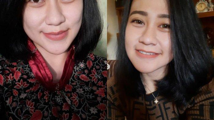 Kabar Terbaru Eva Sofiana, Perawat Dibakar Hidup-hidup di Malang, Kondisi Wajahnya Diungkap Pihak RS