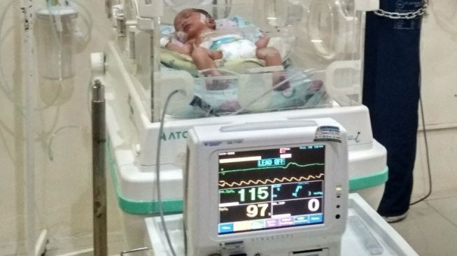 Tertular Covid-19, Bayi Baru Lahir Langsung Meninggal