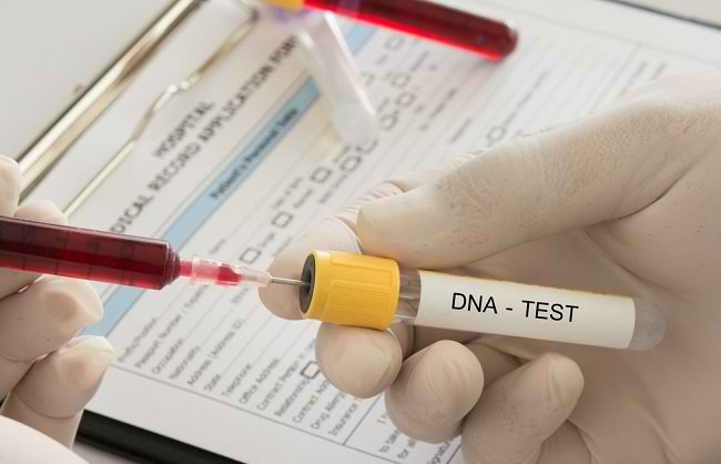 Bolehkah Saya Tes DNA Anak untuk Membuktikan Istri Berzina? 