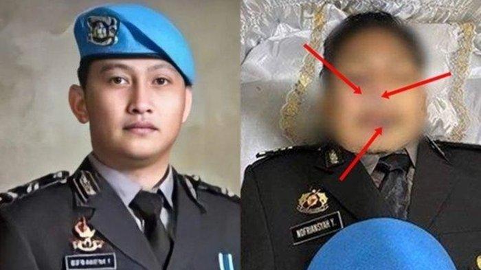 UPDATE Polisi Vs Polisi, Hasil Autopsi Jenazah Brigadir Akan ...