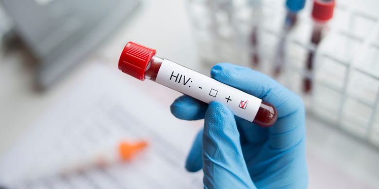 KETAHUI ! Tanda-tanda Awal Kalian Idap HIV, Virus yang Menyerang Sistem Kekebalan Tubuh dan Serang Sel Darah Putih ! 