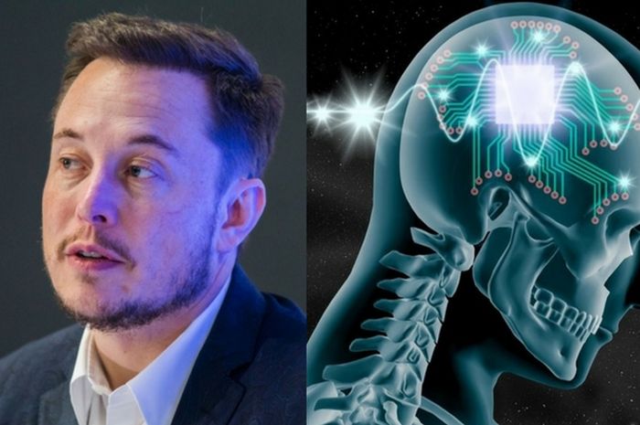 Elon Musk Buat Chip yang Dipasang Pada Otak Manusia, Memungkinkan Untuk Menyembuhkan Orang Lumpuh dan Mengobati Penyakit Otak Lainnya 