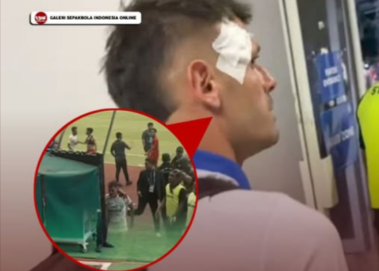 Tyronne del Pino Dikabarkan Alami Luka di Bagian Kepala Karena Kericuhan Supporter di Laga Persija vs Persib