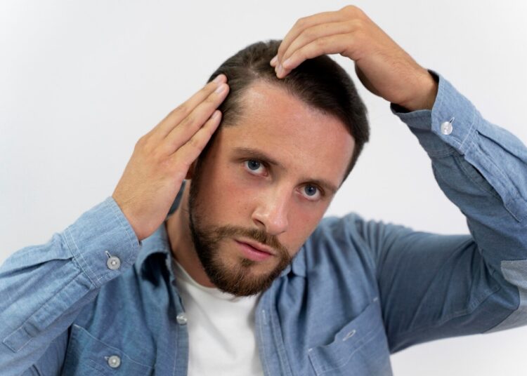 Gausah Galau! Ini Cara Cepat Menumbuhkan Rambut Menjelang Lebaran 2025