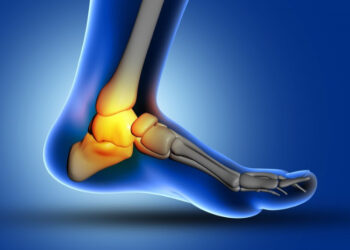 Banyak yang Gak Sadar, Ini Gejala Penyakit Asam Urat, Apa Saja?