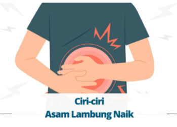 Hidup Tenang Tanpa Gangguan Asam Lambung, Begini Tipsnya!