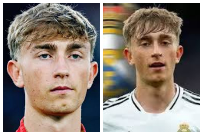 Skuad Real Madrid Alami Krisis Cedera, Alonso Optimis Pemain Kembali Bugar Setelah Jeda