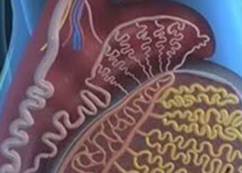 Waduh, Selang Urine Tertinggal di Ginjal Pasien, Dokter Dilaporkan ke Polda Jabar usai MPDKI Vonis Bersalah