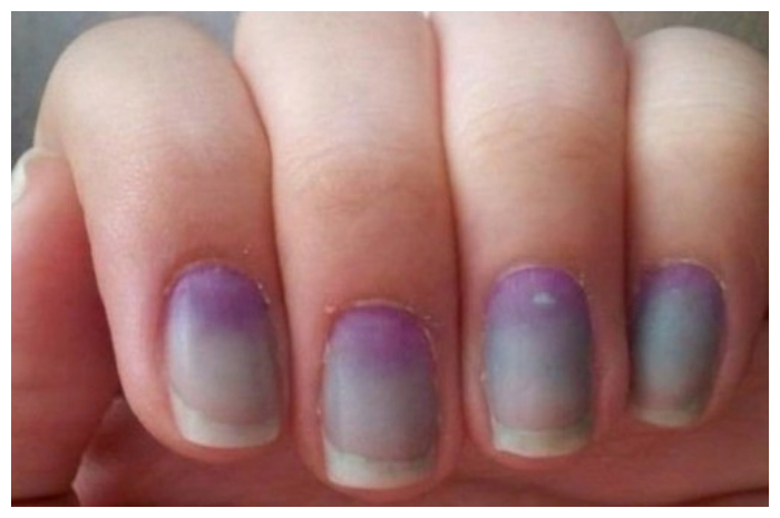 Kuku Tampak Ungu, Normal atau Berbahaya? Simak Penyebabnya!