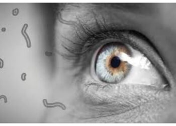 Floaters Mata Tak Boleh Diabaikan, Ini Penjelasannya!