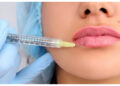 Ingin Wajah Lebih Muda? Kenali Jenis dan Risiko Suntik Filler