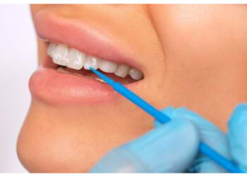 Gigi Bernoda? Ini Faktor Pemicu dan Cara Menjaganya Tetap Putih