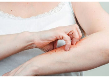 Sering Gatal? Waspadai Gejala Diabetes pada Kulit