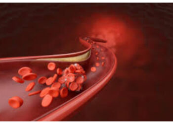 Kolesterol dan Trigliserida Tinggi, Waspadai Hiperlipidemia