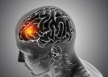 Awas! Ini Tanda-Tanda Stroke yang Perlu Anda ketahui, Apa Saja?