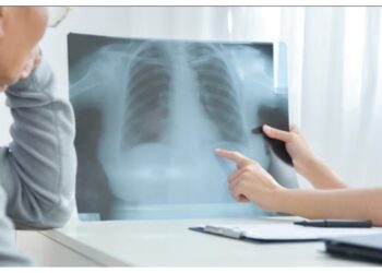 Jangan Sepelekan Infeksi Bakteri pada Paru-Paru, Ini Jenis dan Cara Mengatasinya