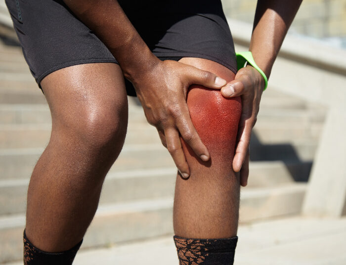 Jangan Dianggap Sepele! Ini Penyebab Nyeri Lutut Saat Olahraga