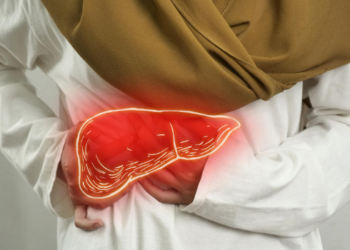 Kenali Hepatitis Sejak Dini untuk Mencegah Kerusakan Hati 3 Kenali Hepatitis Sejak Dini untuk Mencegah Kerusakan Hati