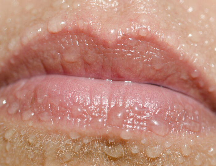 Simpel! Gini Cara Mencegah Bibir Kering dengan Mudah