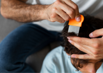 Simpel! Gini Cara Menghilangkan Kutu Rambut dengan Efektif