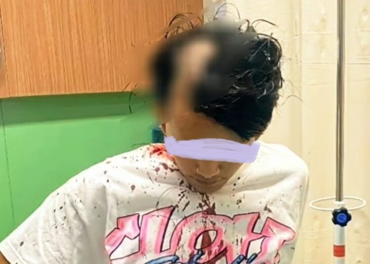 Sadis, 2 Begal Beraksi di Antapani, RM Seorang Pemuda Dibacok, Motor dan Uang Tunai Rp 1,5 Juta Raib