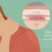 Jangan Abaikan! Kebiasaan Sehari-hari Ini Bisa Picu Meningitis