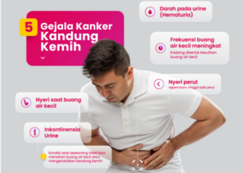 Studi Terbaru Temukan Cara Mengobati Kanker Kandung Kemih Tanpa Angkat Organ