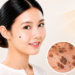 Muncul Bercak atau Benjolan Cokelat di Kulit? Waspadai Keratosis Seboroik