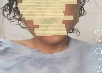 Tiga Tahun Jadi Korban Penyekapan dan Penganiayaan Berat, KemenHAM Turun Tangan 7 Tiga Tahun Jadi Korban Penyekapan dan Penganiayaan Berat, KemenHAM Turun Tangan